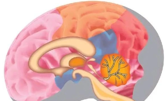 良性腦瘤預後 良性腦瘤預後