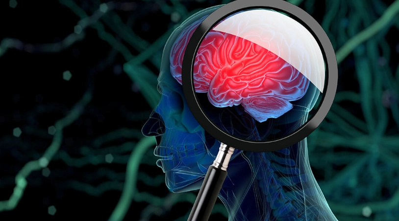 惡性腦瘤治療 惡性腦瘤治療