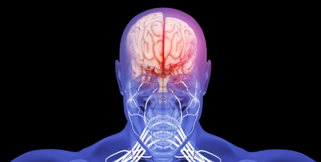 腦瘤症狀 腦瘤症狀