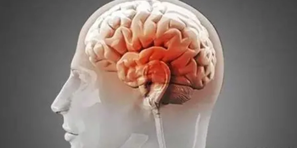 腦瘤預後 腦瘤預後