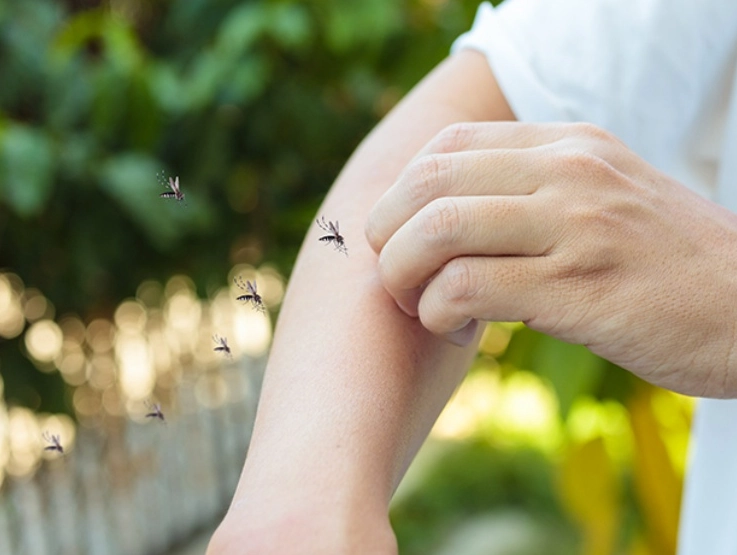 蚊子包消腫時間