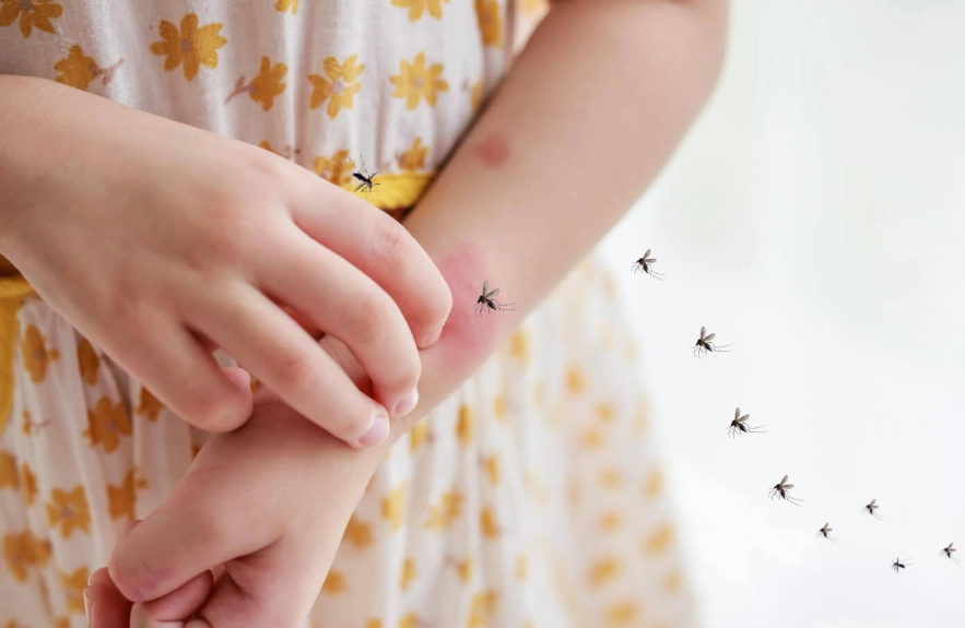 蚊子叮多久會消