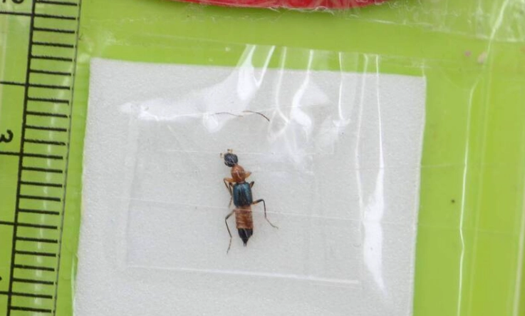 隱翅蟲毒液處理